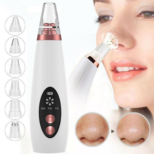 Microcrystalline Blackhead Removal Device
